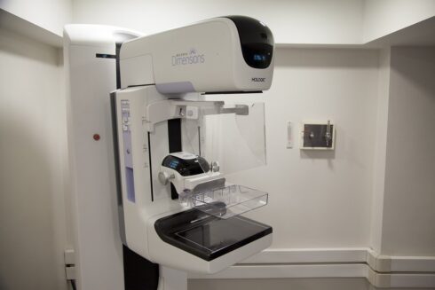 mamógrafo digital