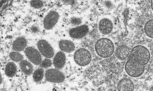 virus-variola-macaco