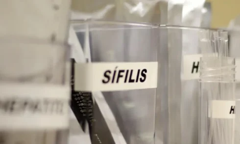 sifilis